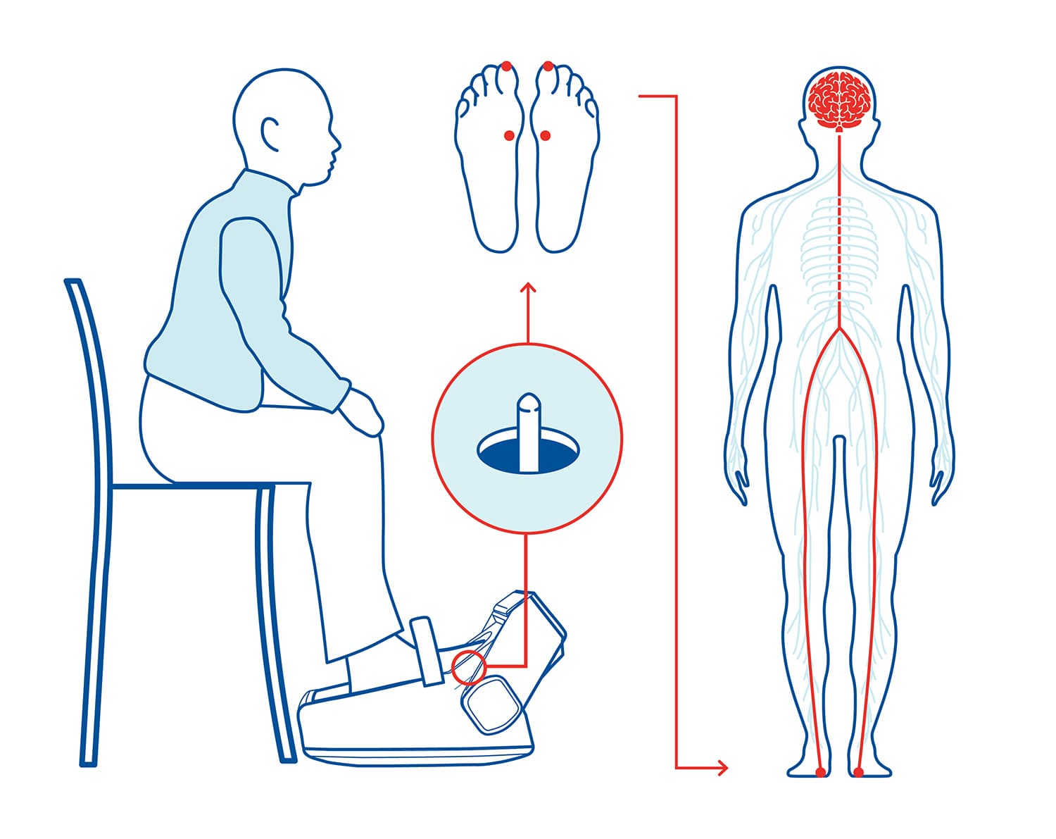 Erogare la terapia AMPS grazie al dispositivo Gondola Home